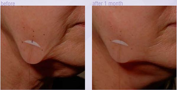 Anti-Gravity Lifting Serum - Incantobeautyshop